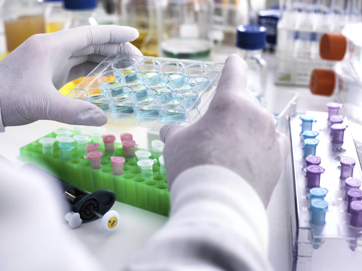 La protection juridique des inventions biotechnologiques : enjeux et défis